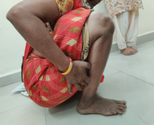 Patient sitting in squatting position post knee preservation surgery